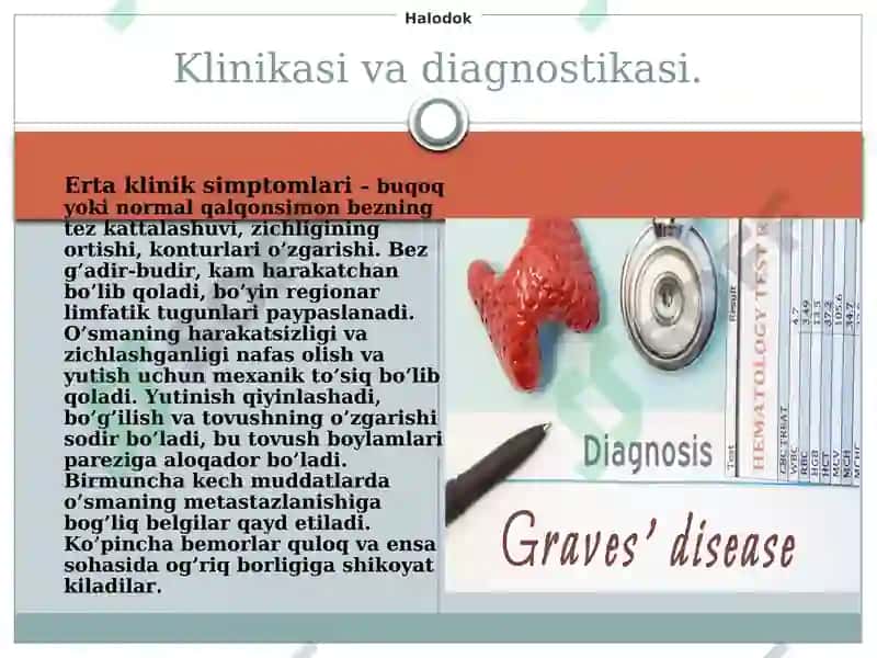 Qalqonsimon bez kasalliklari 8