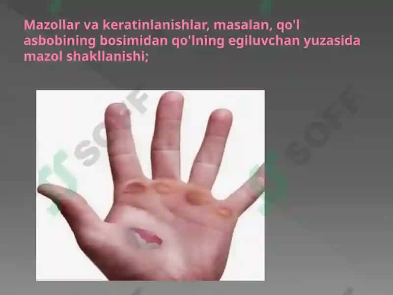 Kasbiy Teri Kasalliklari 8