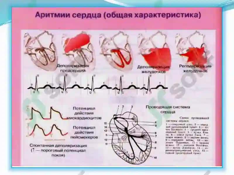 Yurak aritmiyalari 8
