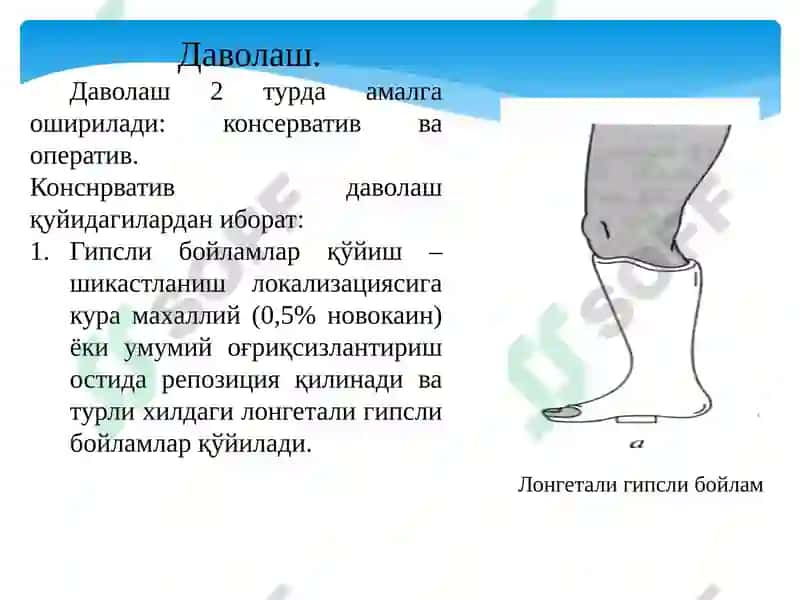 Болдирсуякларишикастланиши 8