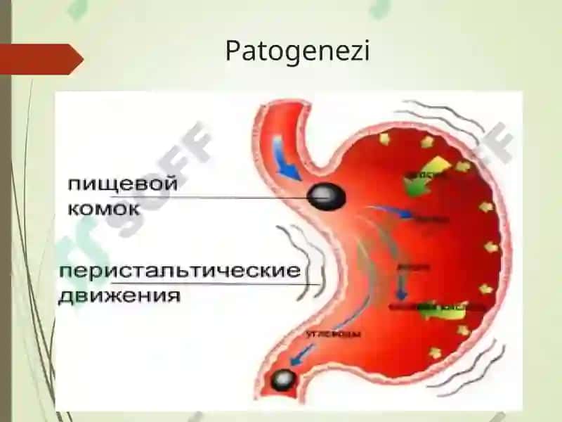 GASTRIT 8