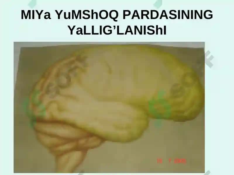 Meningokokk infekstiyasi 8