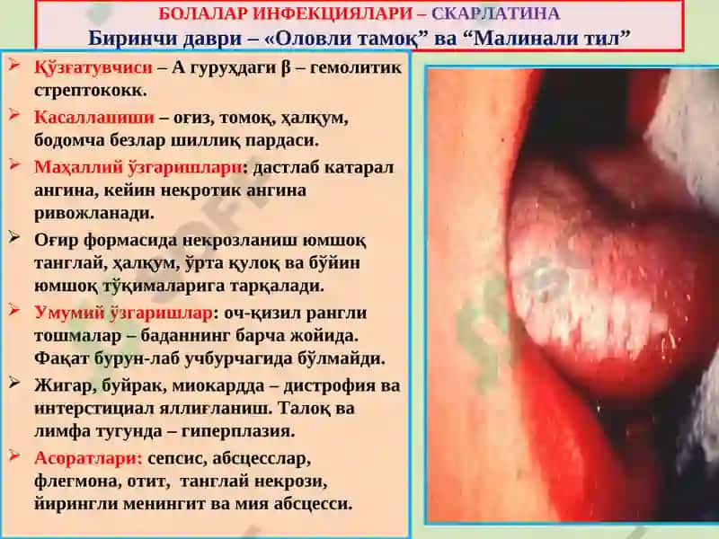 Инфекцион касалликлар 8