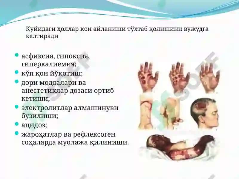 Терминал ҳолатлар 8
