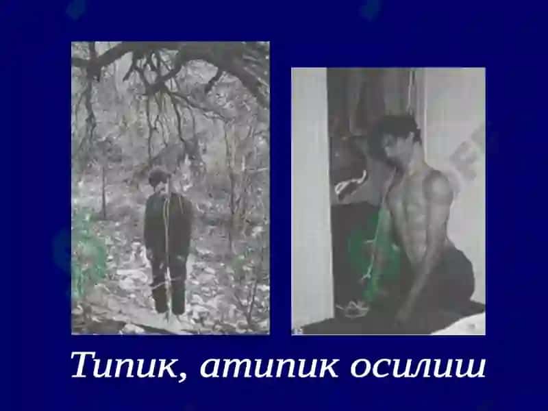 Механик асфиксия 8