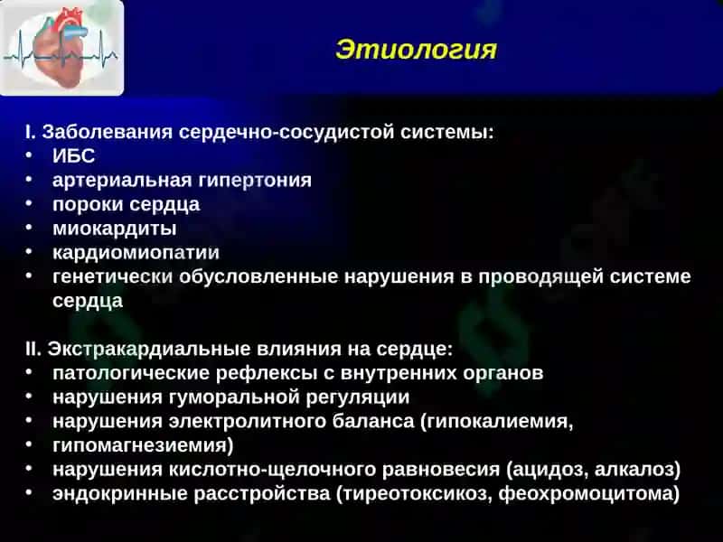 Нарушения ритма и проводимости 8