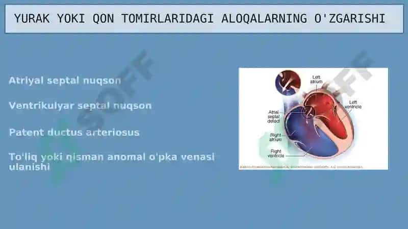 Yurakning tug'ma nuqsonlari 8