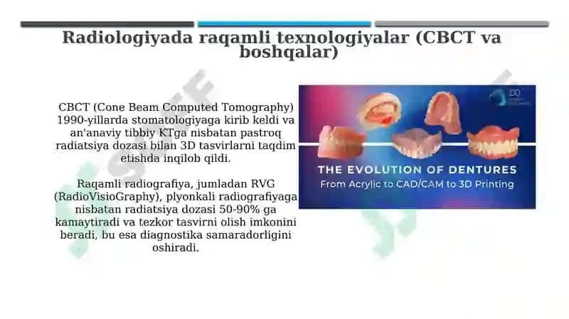Stomatologiyada raqamli texnologiyalar tarixi 8