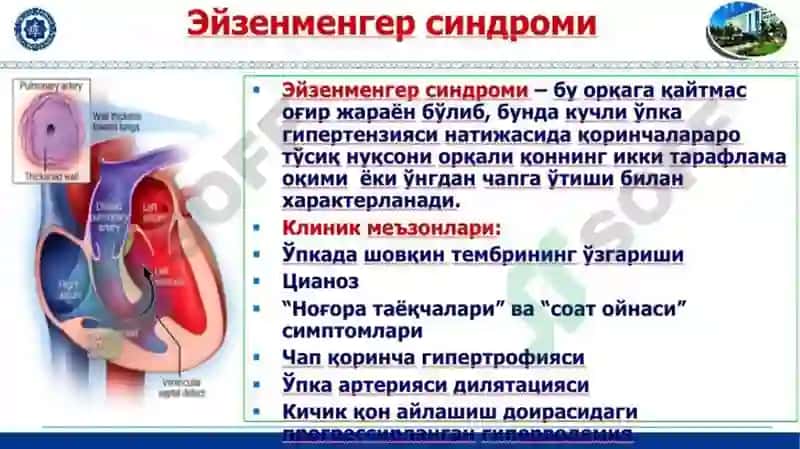 Юрак тугма нуксонлари 8
