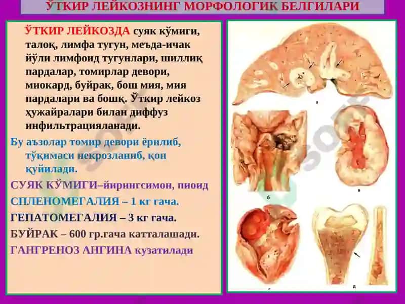 ПАТОЛОГИК АНАТОМИЯ 8