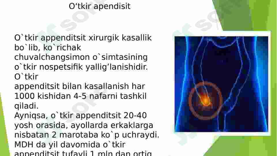 Oʻtkir apendisitni klinikasi
