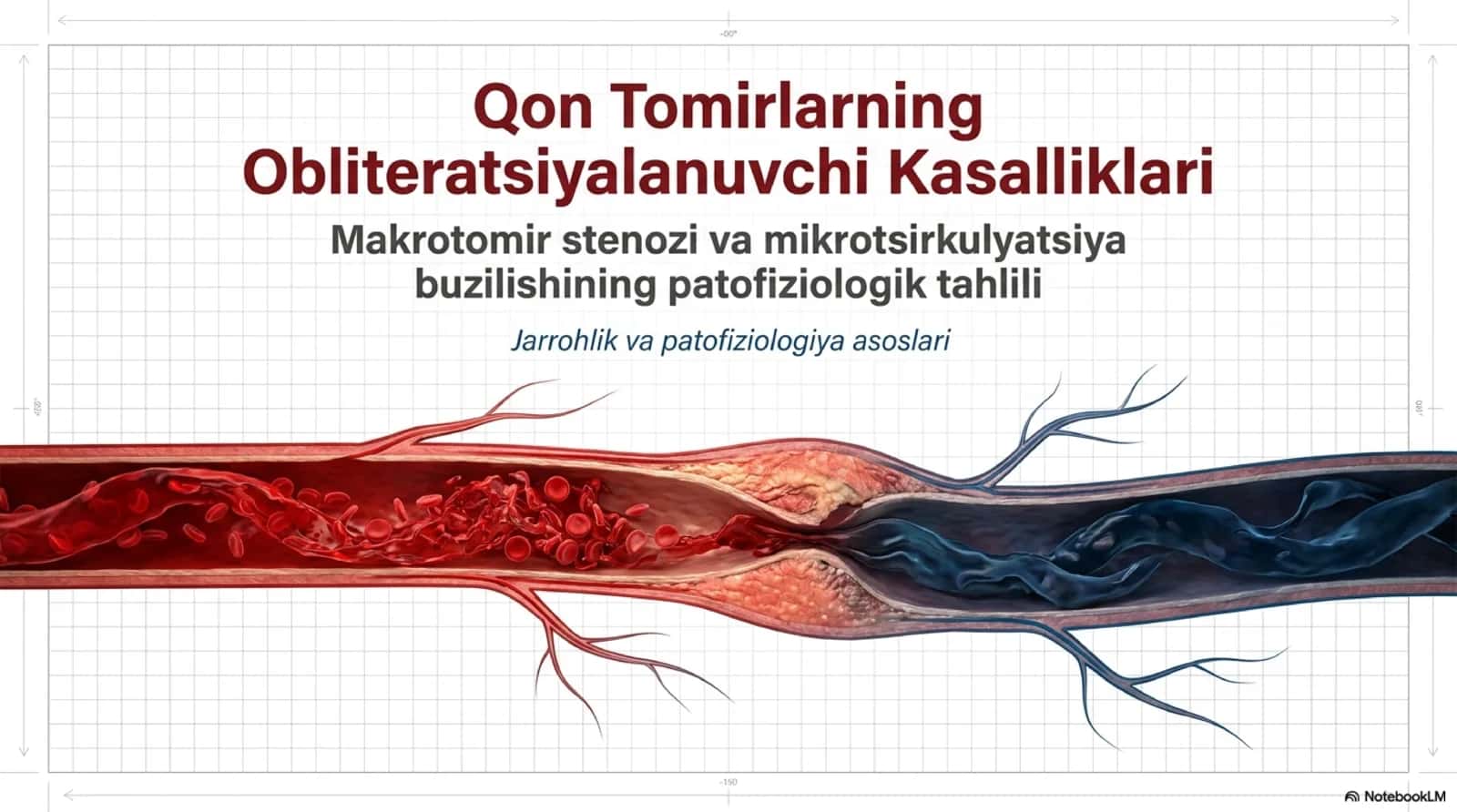 Obliteratsiyalovchi tomir kasalliklari