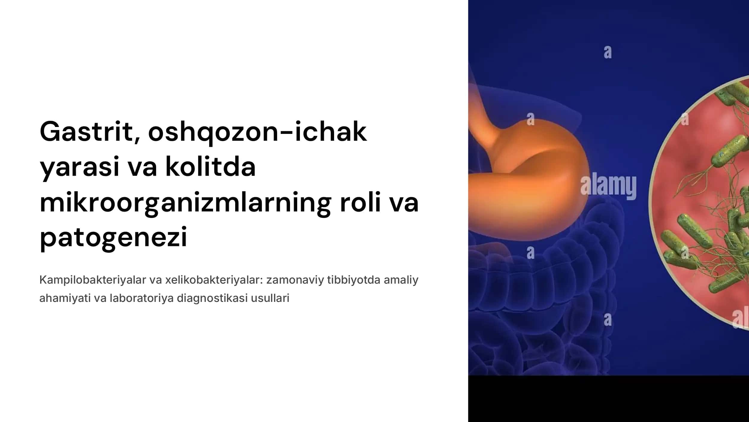 Gastrit, oshqozon-ichak yarasi va kolit kelib chiqishida mikroorganizmlarning ahamiyati, patogenezi, laboratoriya tashxisi. Kampilobakteriyalar, xelikobakteriyalar va ularning amaliyotdagi ahamiyati.