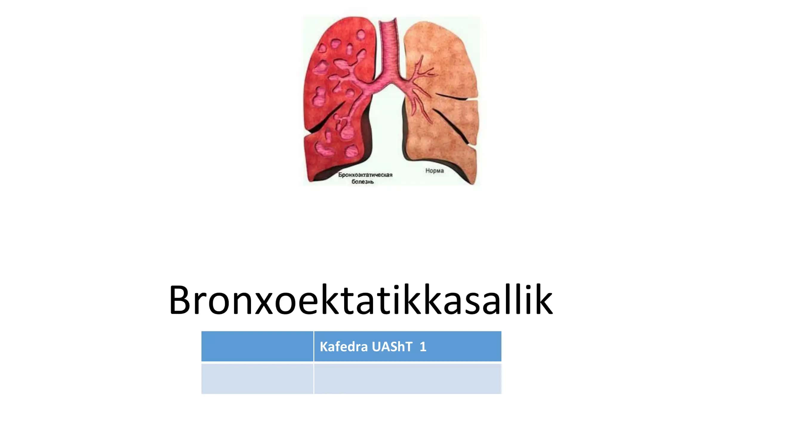 Bronxoektatikkasallik