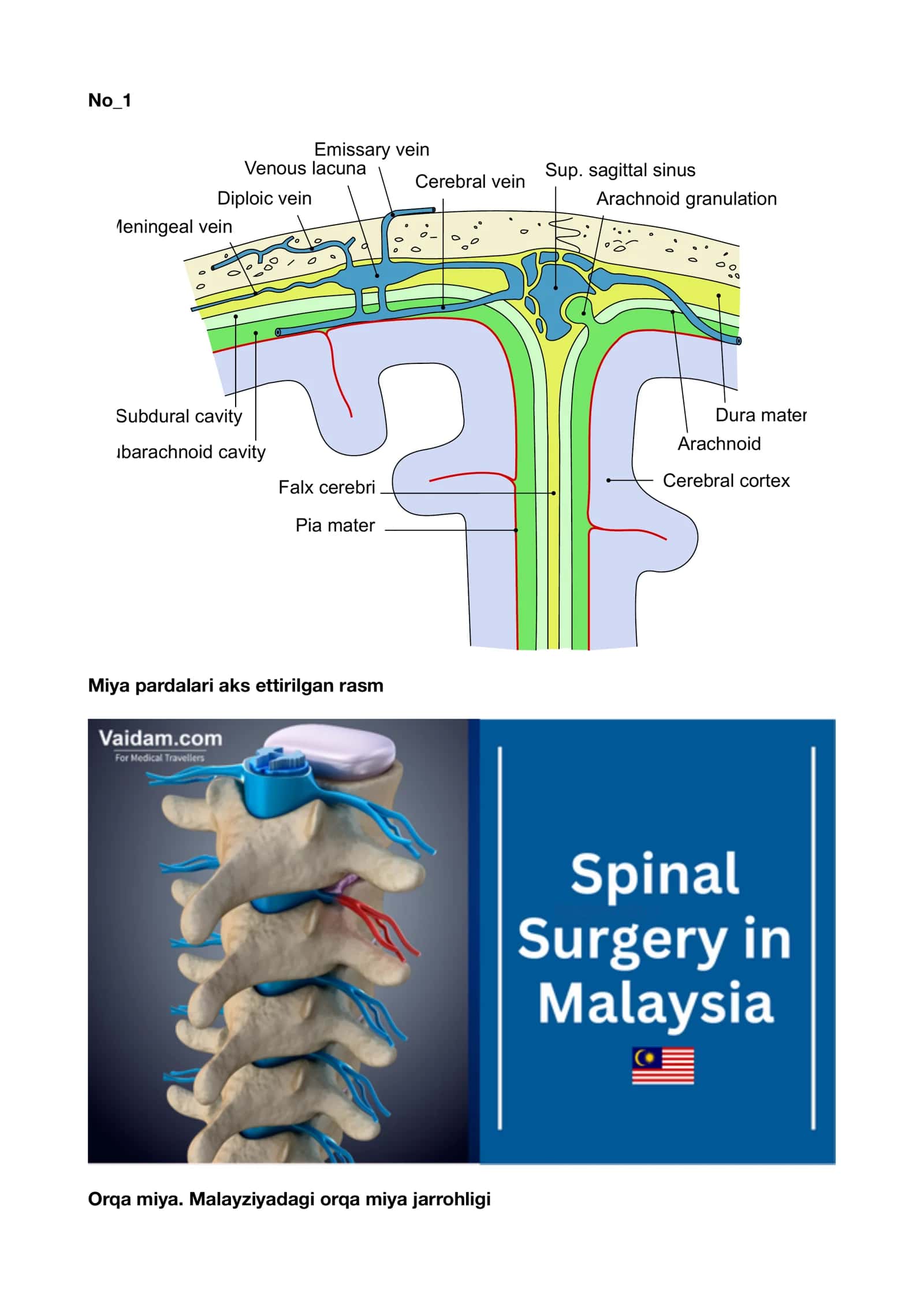 Inson miyasining anatomik preparati