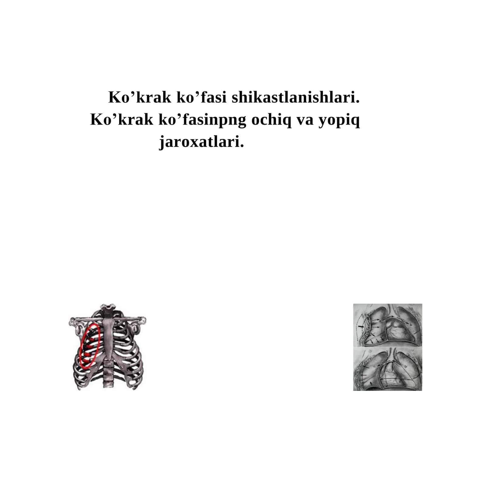 Ko’krak ko’fasi shikastlanishlari