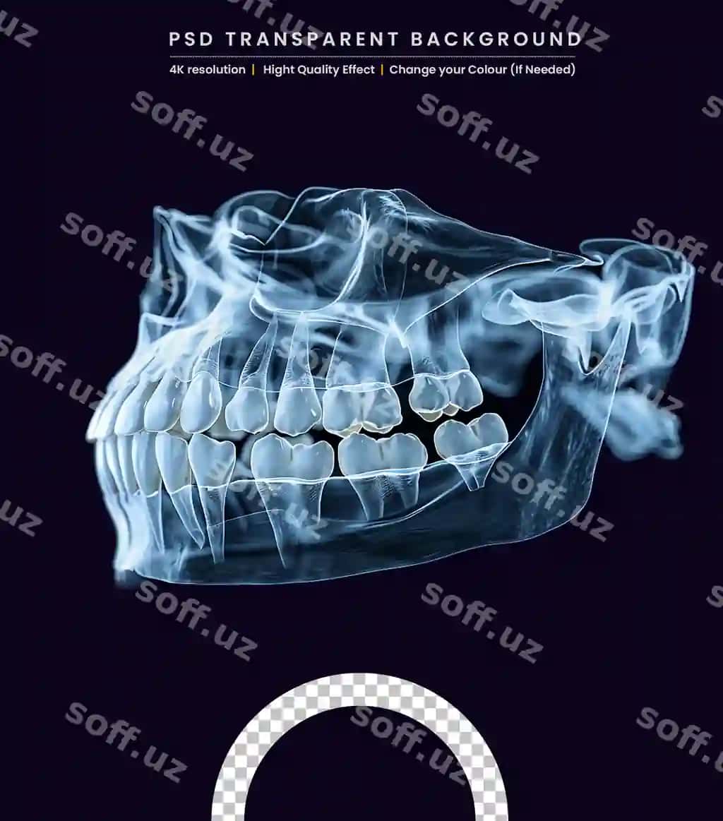 Tish prostetik asbobi yuqori tishlamli qafas bemor tish atigisiz qora fonda | Dental prosthesis upper jaw patient without gum black background