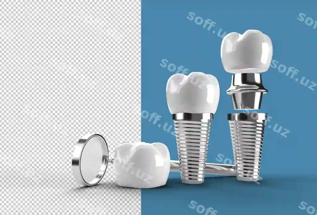 Tish implantlari jarrohiyasi konsepsiyasi shaffof psd fayli | Dental implants surgery concept transparent psd file