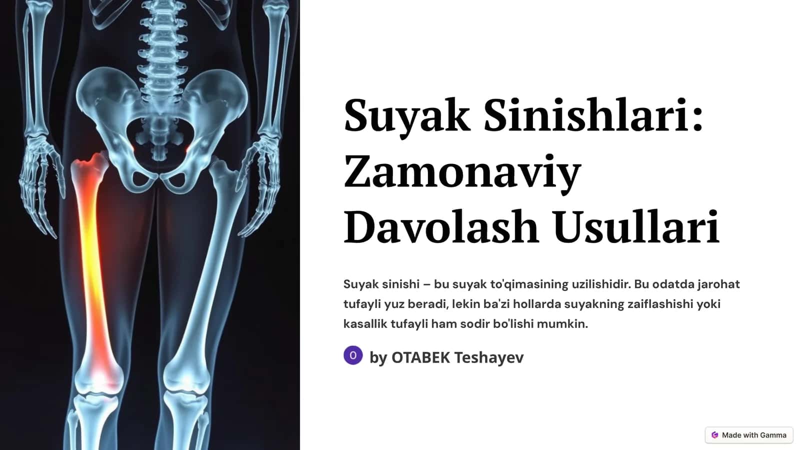 Suyak Sinishlari: Zamonaviy Davolash Usullari