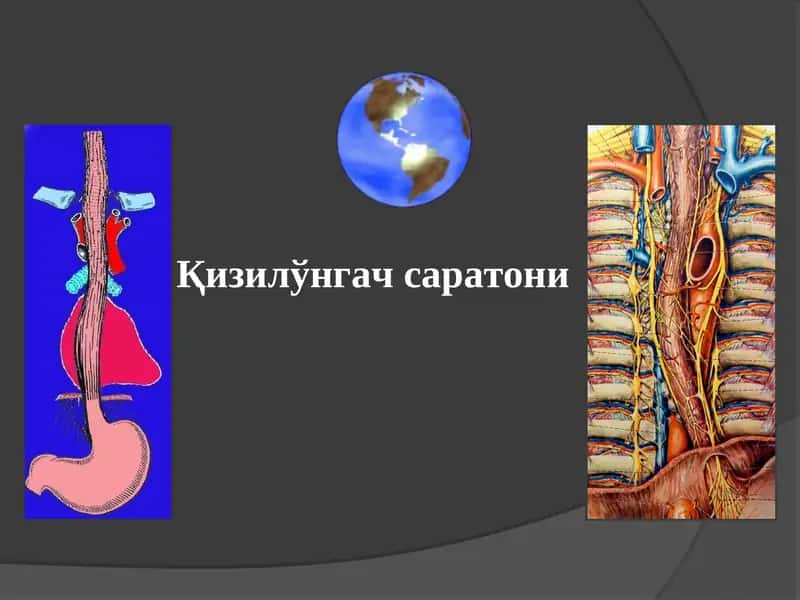 Қизилўнгач саратони
