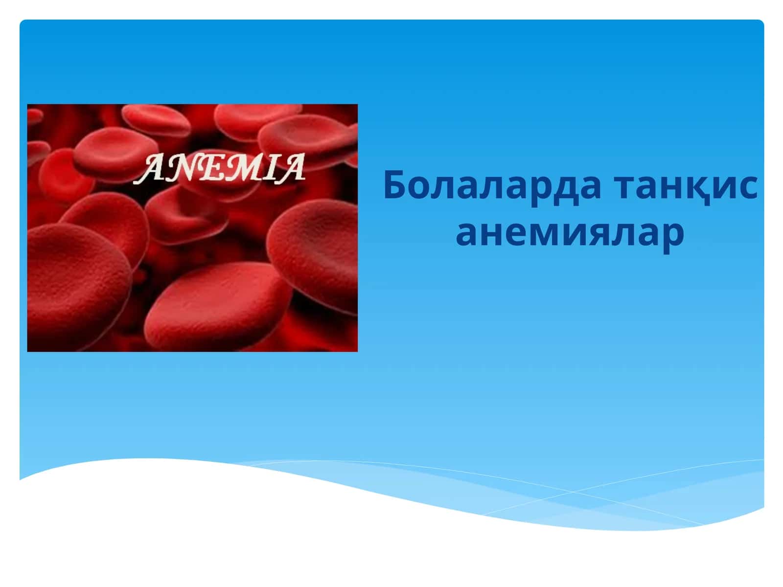 Болаларда танқис анемиялар