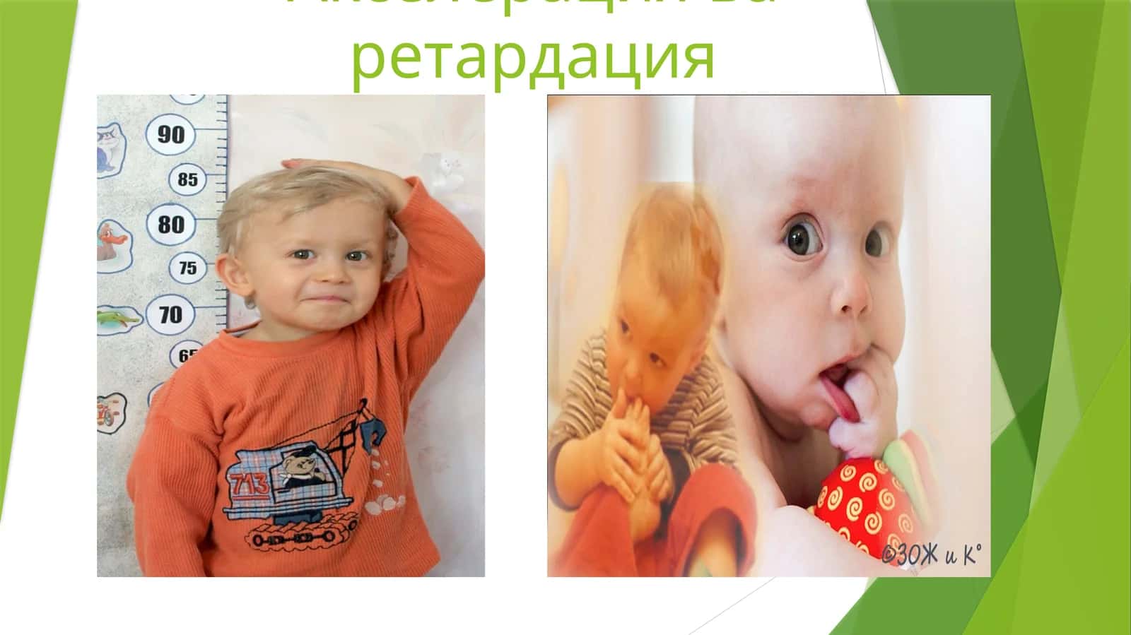 Акселерация ва ретардация