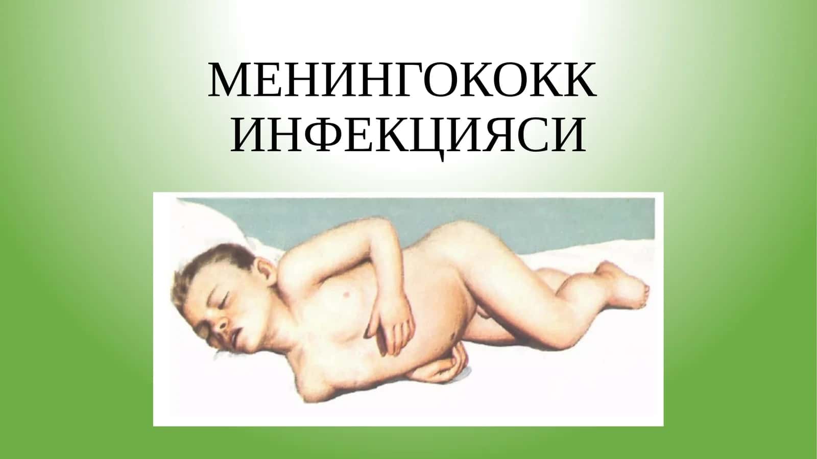 МЕНИНГОКОКК ИНФЕКЦИЯСИ