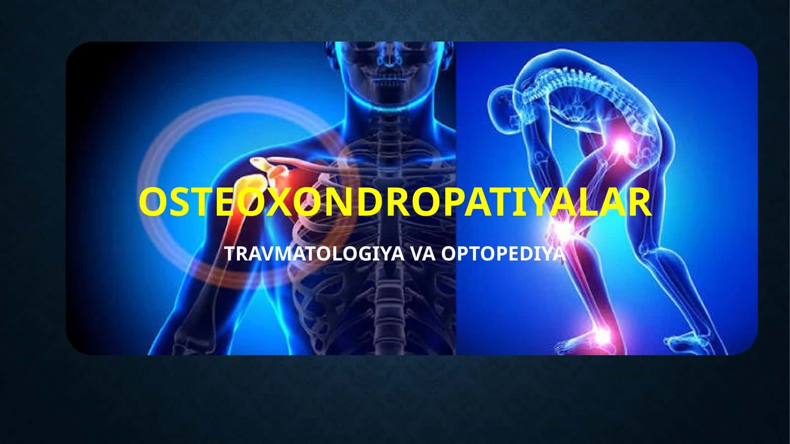 Osteoxondropatiyalar slayd (taqdimot)