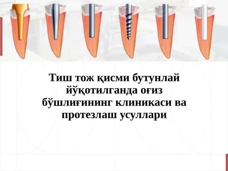 Тиш тож қисми бутунлай йўқотилганда оғиз бўшлиғининг клиникаси ва протезлаш усуллари