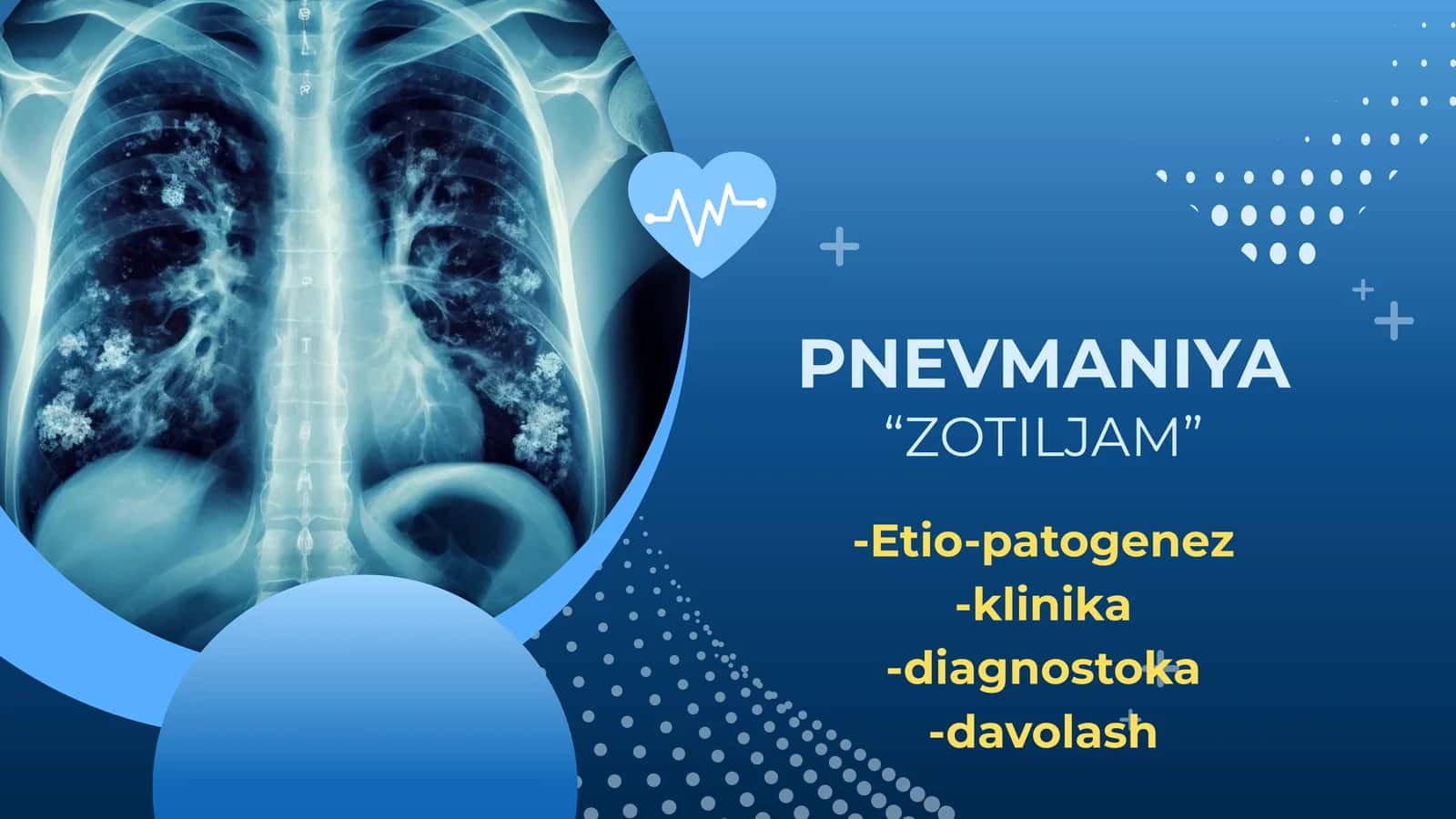 PNEVMANIYA "ZOTILJAM"