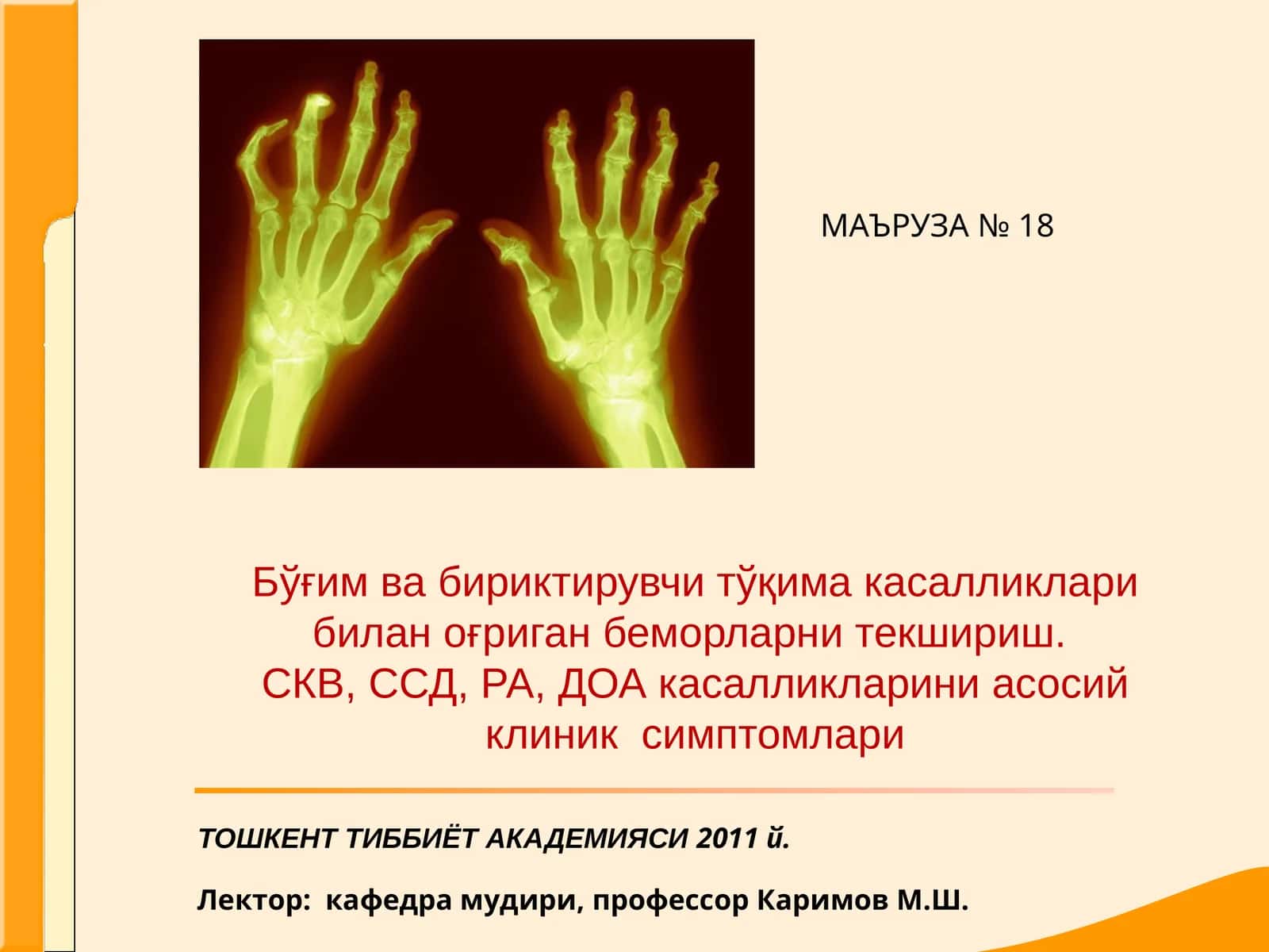 Системали кизил волчанка