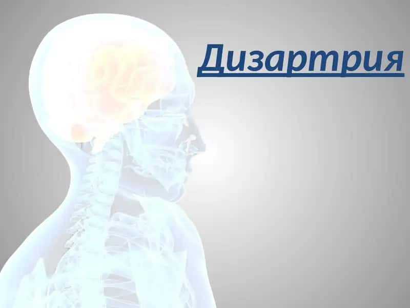 Дизартрия