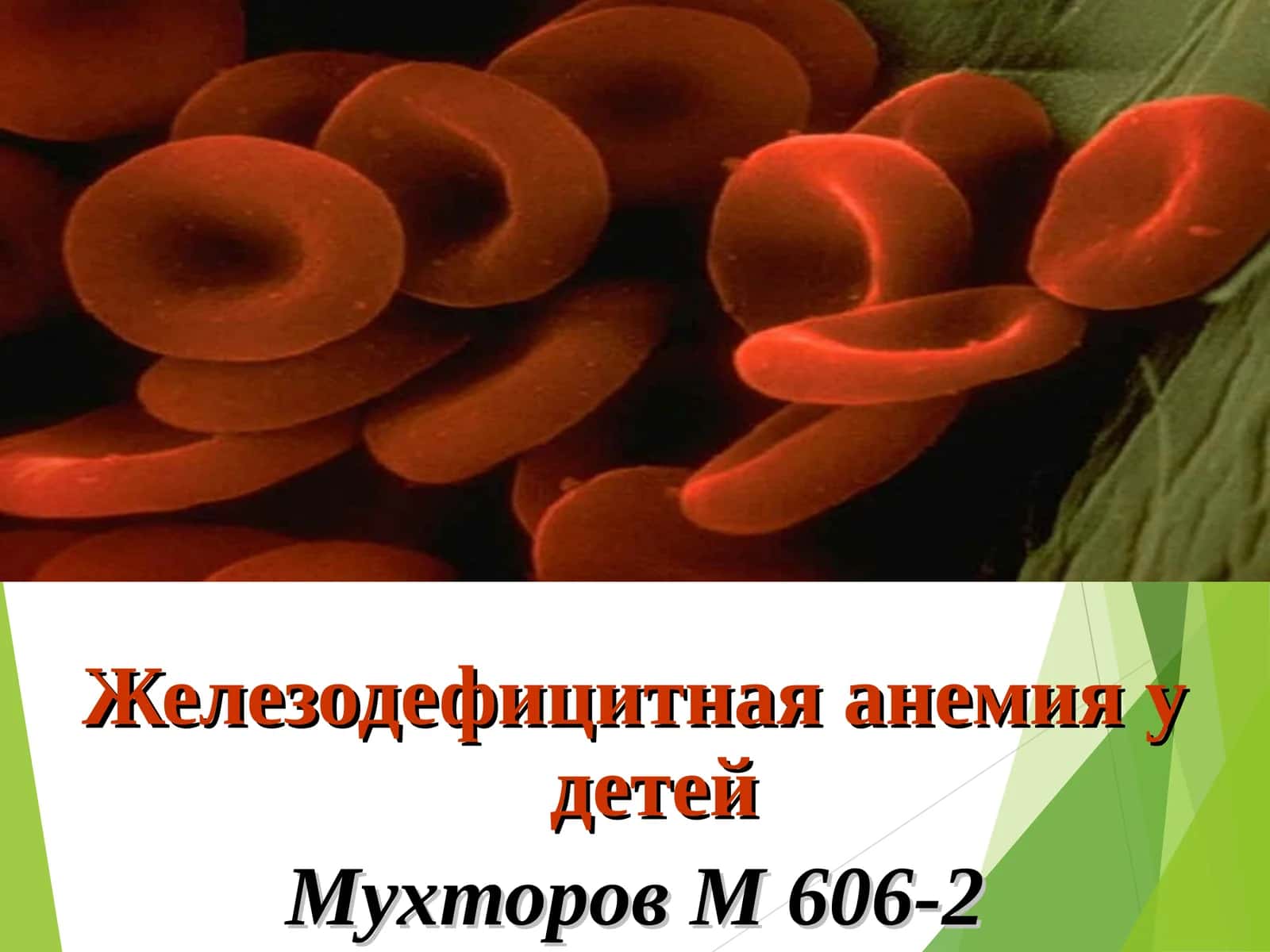 Железодефицитная анемия у детей