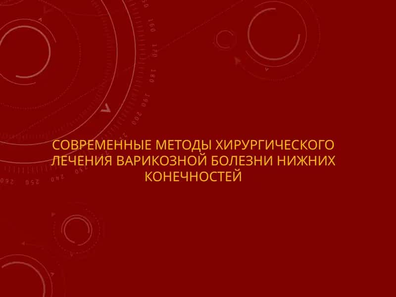СОВРЕМЕННЫЕ МЕТОДЫ ХИРУРГИЧЕСКОГО ЛЕЧЕНИЯ ВАРИКОЗНОЙ БОЛЕЗНИ НИЖНИХ КОНЕЧНОСТЕЙ