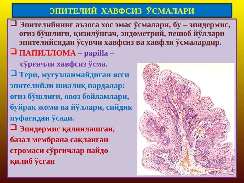 ЭПИТЕЛИЙ ХАВФСИЗЎСМАЛАРИ