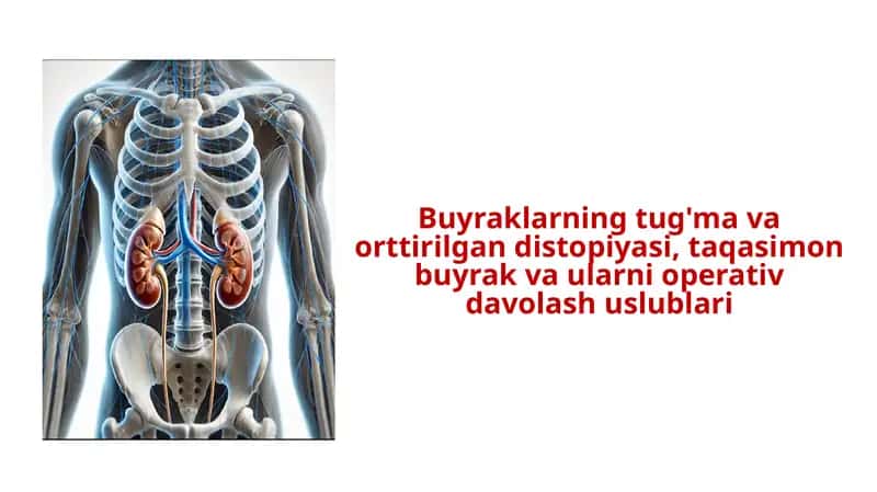 Buyraklarning tug'ma va orttirilgan distopiyasi, taqasimon buyrak va ularni operativ davolash uslublari