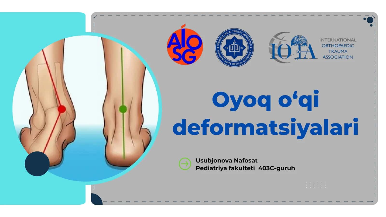 Oyoq o‘qi deformatsiyalari