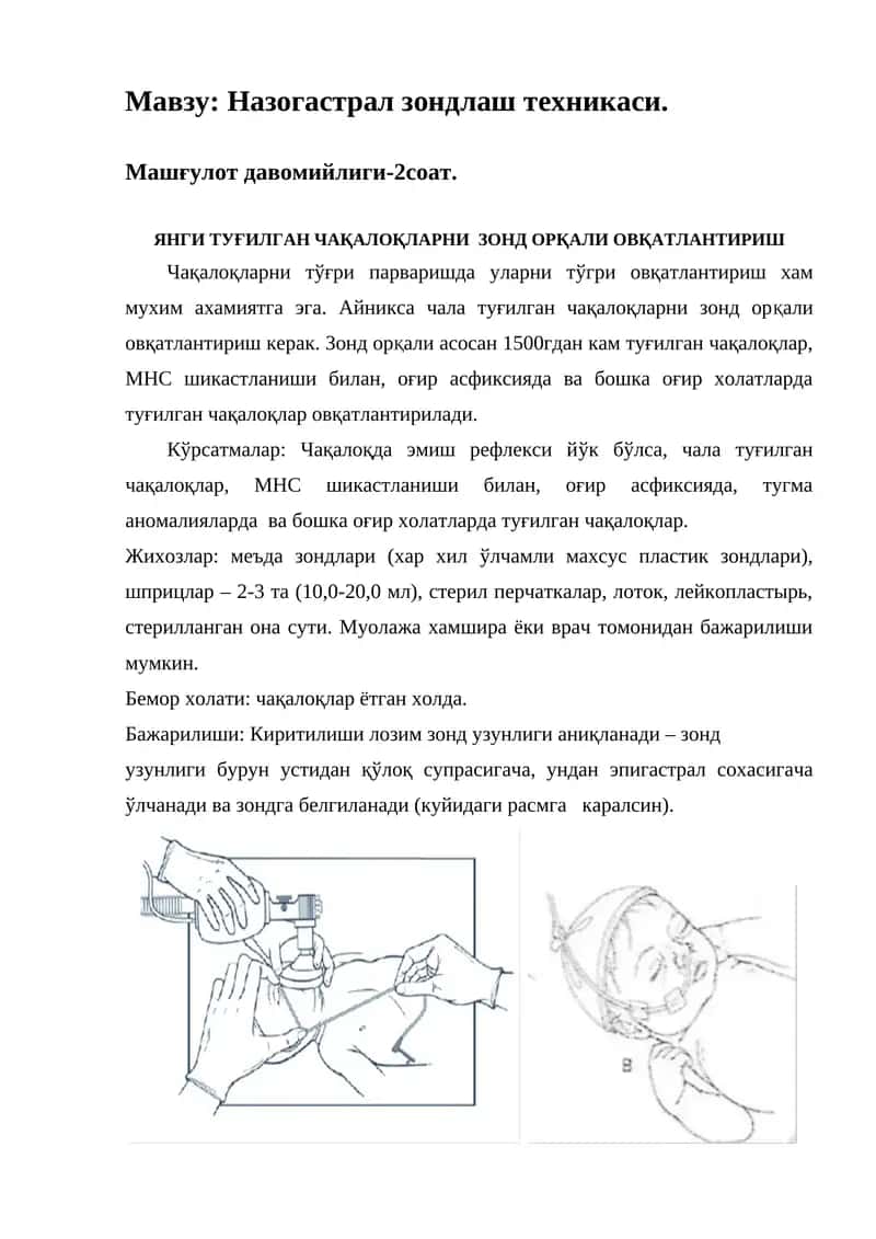 Назогастрал зондлаш техникаси