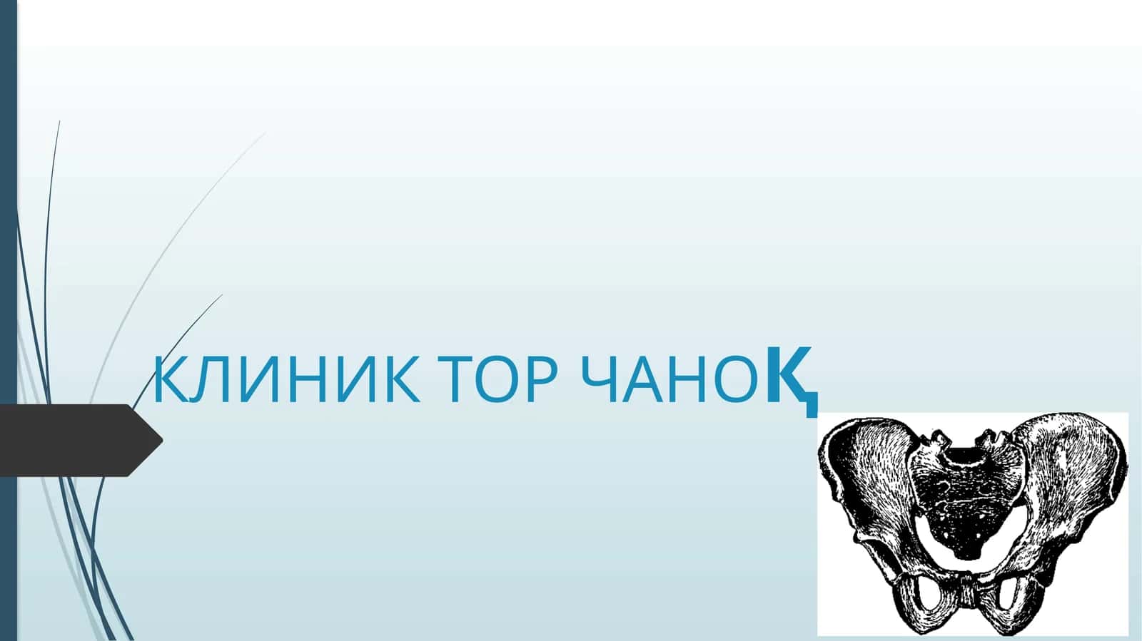 ТОР ЧАНОҚ