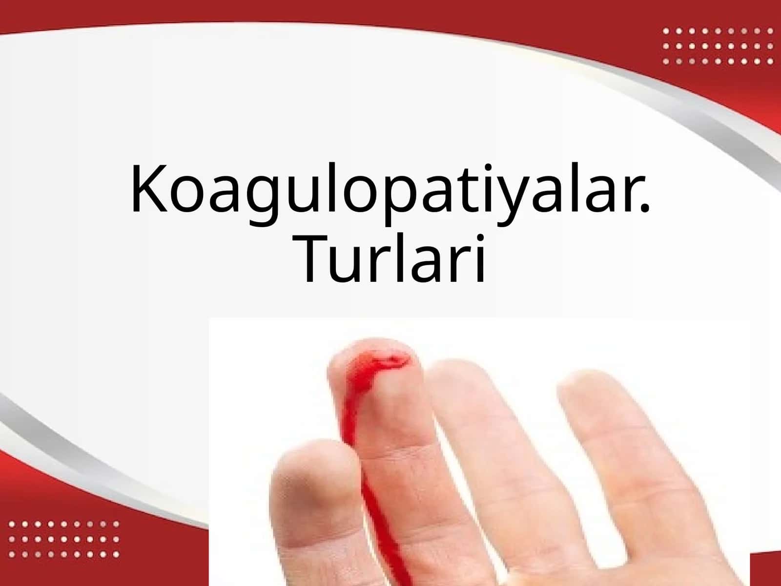 Koagulopatiyalar. Turlari