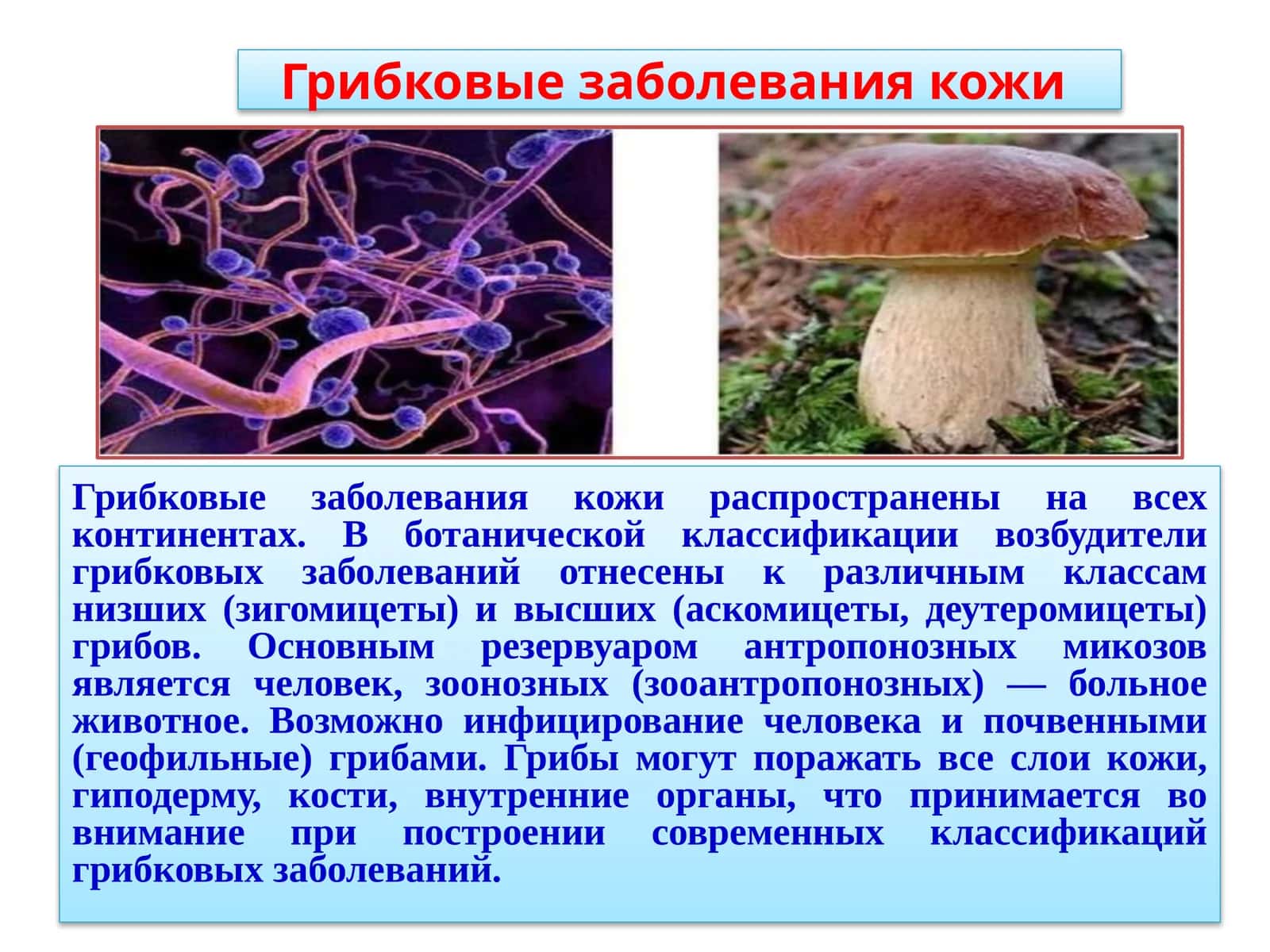 Грибковые заболевания кожи