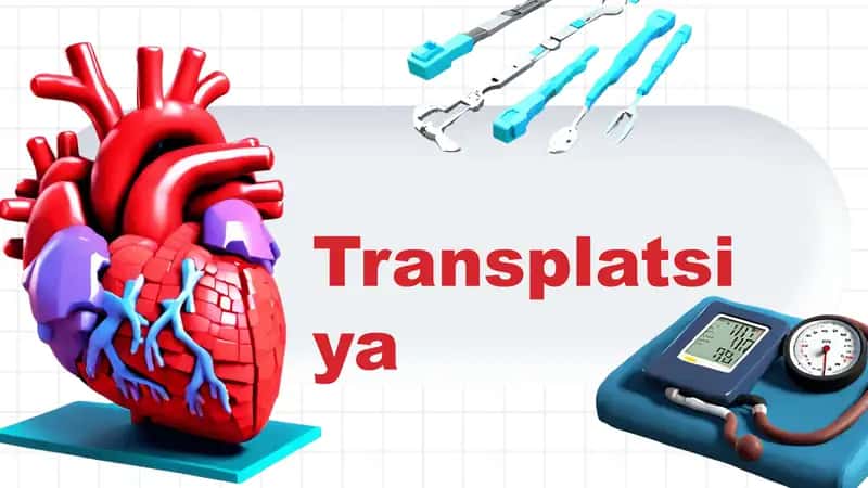 Transplatsiya