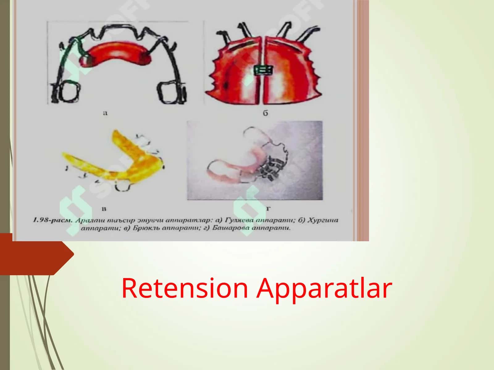 Retension Apparatlar