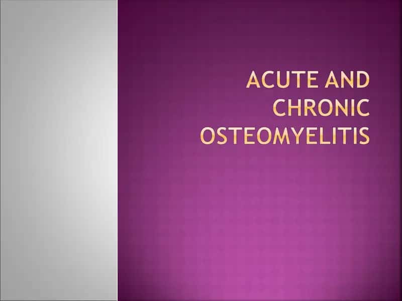 ACUTE AND CHRONIC OSTEOMYELITIS
