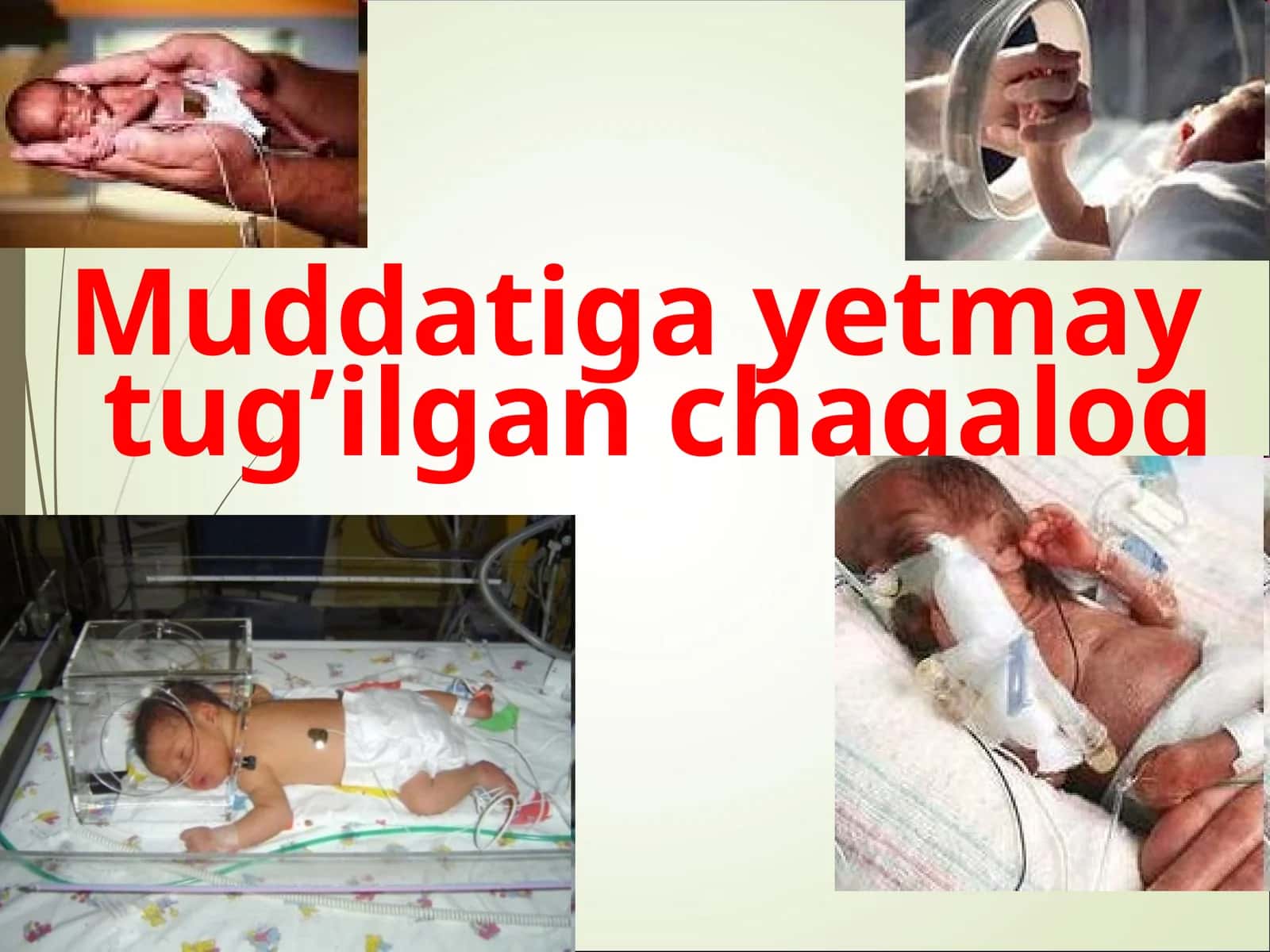 Muddatigayetmay tug’ilgan chaqaloq