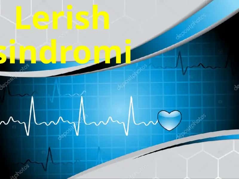Lerish sindromi yurak