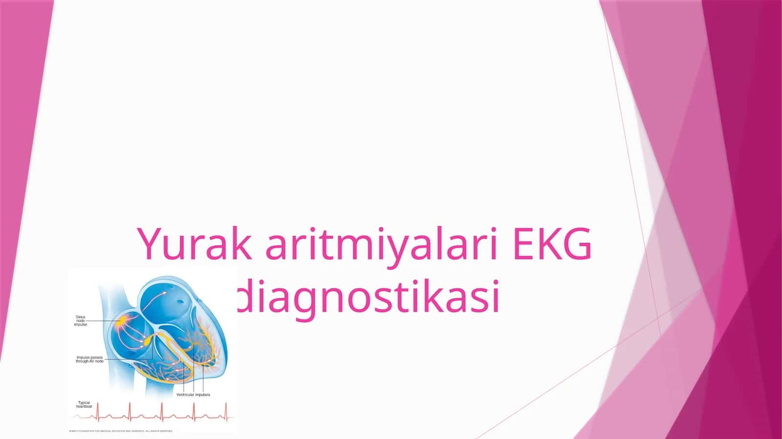 YurakaritmiyalariEKG diagnostikasi