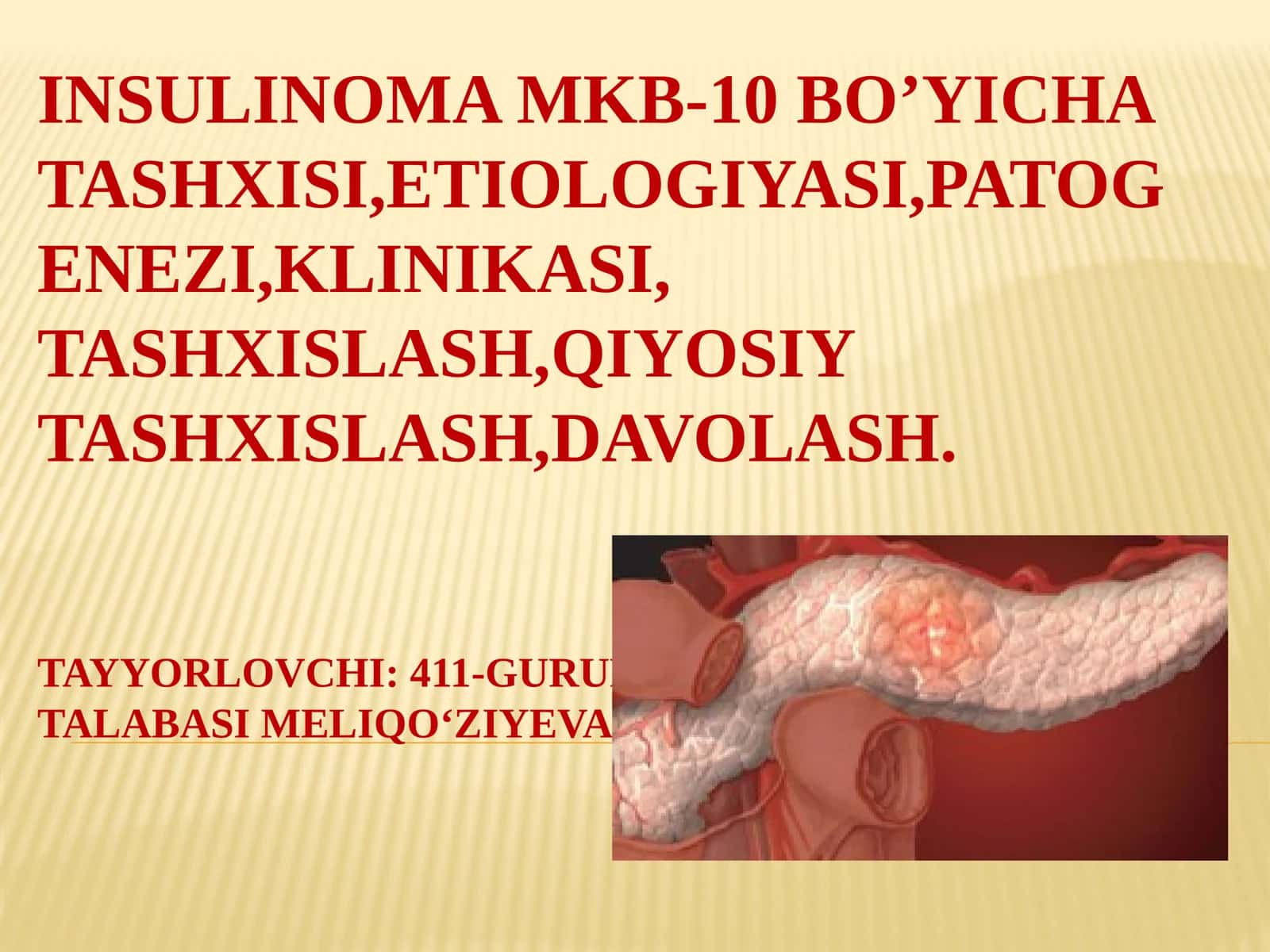 Insulinoma