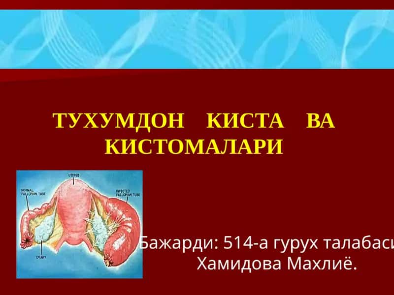 Тухумдон киста ва кистомалари