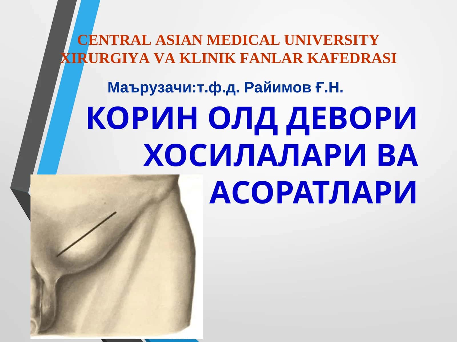 КОРИН ОЛД ДЕВОРИ ХОСИЛАЛАРИ ВА ЧУРРА АСОРАТЛАРИ